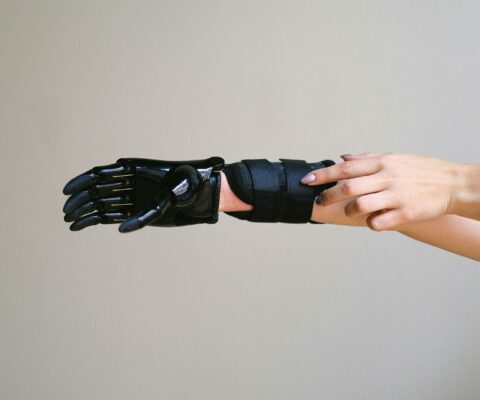 Réalisation d'une prothèse par un stagiaire en CAP opérateur en appareillage orthopédique spécialité orthoprothèse.